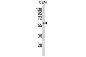 Western blot analysis of FLCN Antibody (Center) in CEM cell line lysates (35ug/lane). (FLCN 抗体  (Middle Region))