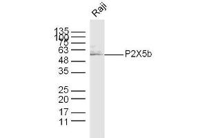 Raji (hu) lysates probed with P2X5b Polyclonal Antibody, unconjugated  at 1:300 overnight at 4°C followed by a conjugated secondary antibody at 1:10000 for 60 minutes at 37°C. (P2X5b (AA 261-360) 抗体)