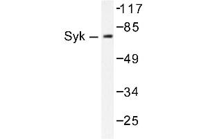 Image no. 1 for anti-Spleen tyrosine Kinase (SYK) antibody (ABIN271834) (SYK 抗体)