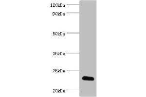 Western blot All lanes: FGF6 antibody at 10 μg/mL + HepG2 whole cell lysate Secondary Goat polyclonal to rabbit IgG at 1/10000 dilution Predicted band size: 23 kDa Observed band size: 23 kDa (FGF6 抗体  (AA 38-208))