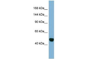 Host:  Rabbit  Target Name:  MAML3  Sample Type:  Fetal Stomach lysates  Antibody Dilution:  1. (MAML3 抗体  (C-Term))