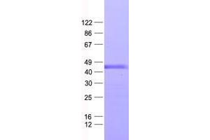 Western Blotting (WB) image for Zinc Finger Protein 558 (ZNF558) protein (His tag) (ABIN2736068)