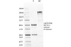 SDS-PAGE Analysis Purified Cytokeratin 14 Mouse Monoclonal Antibody (LL002). (KRT14 抗体  (C-Term))