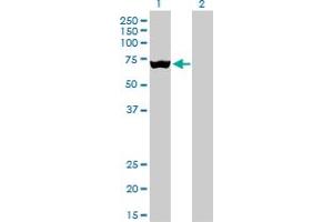 Western Blot analysis of SLC25A13 expression in transfected 293T cell line by SLC25A13 monoclonal antibody (M01), clone 4F4. (slc25a13 抗体  (AA 2-80))