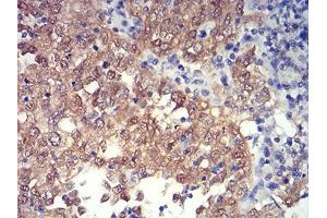 Immunohistochemistry (IHC) image for anti-PR Domain Containing 4 (PRDM4) (AA 476-575) antibody (ABIN5874480) (PRDM4 抗体  (AA 476-575))
