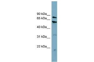 WB Suggested Anti-CPT1B  Antibody Titration: 0. (CPT1B 抗体  (Middle Region))