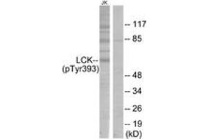 Western blot analysis of extracts from Jurkat cells, using Lck (Phospho-Tyr393) Antibody. (LCK 抗体  (pTyr394))
