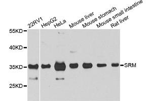 Western blot analysis of extracts of various cell lines, using SRM antibody. (Spermidine Synthase 抗体)