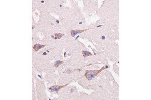 D staining Nestin in human brain tissue sections by Immunohistochemistry (IHC-P - paraformaldehyde-fixed, paraffin-embedded sections). (Nestin 抗体  (AA 1389-1416))