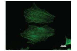 Immunostaining analysis in HeLa cells. (beta Actin 抗体)