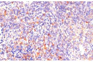 Immunohistochemistry of paraffin-embedded Mouse spleen using ROCK1 Polyclonal Antibody at dilution of 1:100 (40x lens). (ROCK1 抗体)