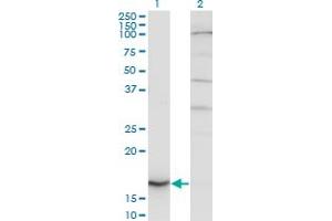 Western Blot analysis of CYB5A expression in transfected 293T cell line by CYB5A monoclonal antibody (M06), clone 1A8.