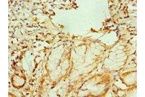 Immunohistochemistry of paraffin-embedded human gallbladder tissue using ABIN7151755 at dilution of 1:100