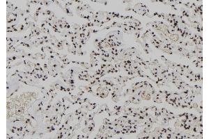 ABIN6278212 at 1/100 staining Human lung tissue by IHC-P. (XPO4 抗体  (N-Term))