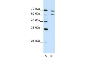 Western Blotting (WB) image for anti-Cleavage and Polyadenylation Specific Factor 3, 73kDa (CPSF3) antibody (ABIN2462266) (CPSF3 抗体)