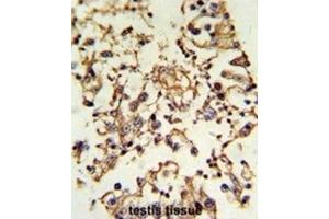 Immunohistochemistry (IHC) image for anti-Protein Kinase A, alpha (PRKACA) antibody (ABIN3002818) (PRKACA 抗体)