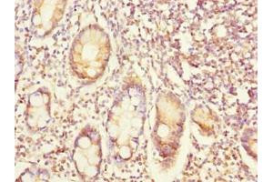 Immunohistochemistry of paraffin-embedded human small intestine tissue using ABIN7152363 at dilution of 1:100 (EYA3 抗体  (AA 1-300))