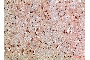 Immunohistochemical analysis of paraffin-embedded human-brain, antibody was diluted at 1:200 (NLRX1 抗体  (AA 581-630))