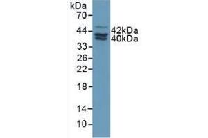 Detection of PAI2 in Human MCF7 Cells using Polyclonal Antibody to Plasminogen Activator Inhibitor 2 (PAI2) (SERPINB2 抗体  (AA 154-408))