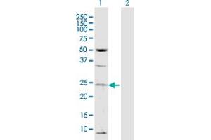 Western Blot analysis of TAF13 expression in transfected 293T cell line by TAF13 MaxPab polyclonal antibody. (TAF13 抗体  (AA 1-124))