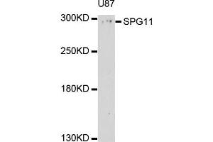 Western blot analysis of extract of U87 cells, using SPG11 antibody. (SPG11 抗体)