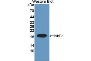 Detection of Recombinant TOP3, Human using Polyclonal Antibody to Topoisomerase III (TOP3) (TOP3 抗体  (AA 35-179))