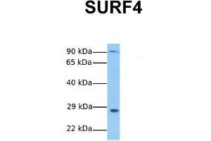 Host:  Rabbit  Target Name:  SURF4  Sample Tissue:  Human Stomach Tumor  Antibody Dilution:  1. (Surfeit 4 抗体  (N-Term))