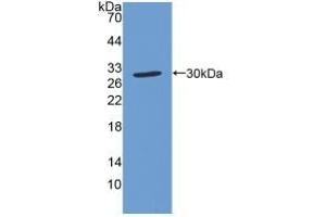Detection of Recombinant SOD4, Human using Polyclonal Antibody to Superoxide Dismutase Copper Chaperone (Superoxide dismutase copper chaperone 抗体  (AA 23-269))