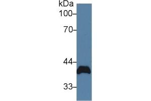 Detection of PVR in Rat Heart lysate using Polyclonal Antibody to Poliovirus Receptor (PVR) (Poliovirus Receptor 抗体  (AA 22-255))