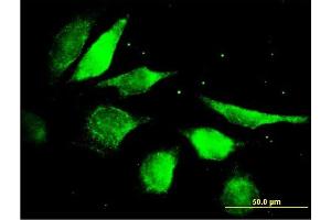 Immunofluorescence of purified MaxPab antibody to FGF5 on HeLa cell. (FGF5 抗体  (AA 1-123))