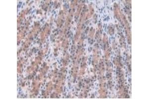 Detection of a1AGP in Rat Stomach Tissue using Monoclonal Antibody to Alpha-1-Acid Glycoprotein (a1AGP) (ORM1 抗体  (AA 19-186))