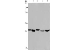 Western Blotting (WB) image for anti-Enoyl CoA Hydratase, Short Chain, 1, Mitochondrial (ECHS1) antibody (ABIN2423345) (ECHS1 抗体)