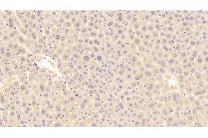 Detection of ROR1 in Mouse Liver Tissue using Polyclonal Antibody to Receptor Tyrosine Kinase Like Orphan Receptor 1 (ROR1) (ROR1 抗体  (AA 470-707))