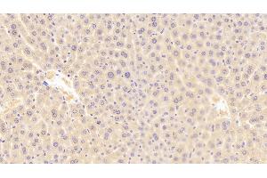 Detection of ROR1 in Mouse Liver Tissue using Polyclonal Antibody to Receptor Tyrosine Kinase Like Orphan Receptor 1 (ROR1) (ROR1 抗体  (AA 470-707))