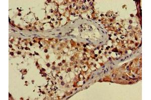 Immunohistochemistry (IHC) image for anti-Protein Phosphatase 2, Regulatory Subunit B'', alpha (PPP2R3A) (AA 256-508), (Regulatory Subunit B) antibody (ABIN7169274)