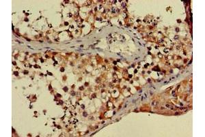 Immunohistochemistry of paraffin-embedded human testis tissue using ABIN7169274 at dilution of 1:100