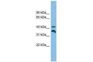 RRAGC antibody used at 1 ug/ml to detect target protein. (GTR2 抗体  (N-Term))