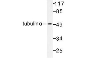 Image no. 1 for anti-Tubulin, alpha 1B (TUBA1B) antibody (ABIN272103) (TUBA1B 抗体)