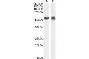 Western Blot using anti-p53 antibody PAb42. (Recombinant p53 抗体  (AA 371-380))