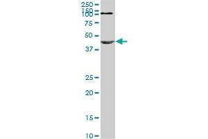 NODAL monoclonal antibody (M03), clone 5C3. (Nodal 抗体  (AA 275-346))