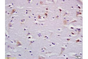 Formalin-fixed and paraffin embedded rat brain labeled with Anti-BBS9 Polyclonal Antibody, Unconjugated (ABIN1387812) at 1:200 followed by conjugation to the secondary antibody and DAB staining (BBS9 抗体  (AA 244-320))