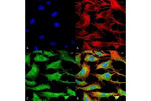 Immunocytochemistry/Immunofluorescence analysis using Mouse Anti-Copper Transporting ATPase 2 Monoclonal Antibody, Clone S62-29 . (ATP7B 抗体  (AA 3-21) (PE))