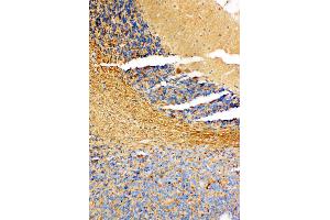 Immunohistochemistry (IHC) image for anti-Non-Metastatic Cells 1, Protein (NM23A) Expressed in (NME1) (AA 137-152), (C-Term) antibody (ABIN3044197)