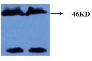 Western Blotting (WB) image for anti-Microtubule-Associated Protein tau (MAPT) (AA 177-187), (pThr181) antibody (ABIN1108152) (MAPT 抗体  (pThr181))