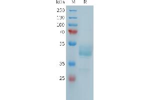SDS-PAGE (SDS) image for Fc Receptor-Like 5 (FCRL5) (AA 752-834) protein (mFc Tag) (ABIN7538228)