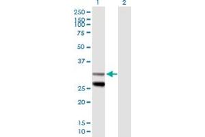 Western Blot analysis of SCO1 expression in transfected 293T cell line by SCO1 MaxPab polyclonal antibody. (SCO1 抗体  (AA 1-301))