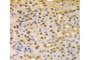 Immunohistochemistry of paraffin-embedded Rat kidney using COPS5 Polyclonal Antibody at dilution of 1:100 (40x lens). (COPS5 抗体)