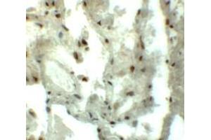 Immunohistochemistry (IHC) image for anti-Myocardial Zonula Adherens Protein (MYZAP) (C-Term) antibody (ABIN1030527) (MYZAP 抗体  (C-Term))