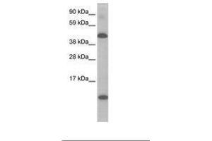 Image no. 1 for anti-Ligand Dependent Nuclear Receptor Corepressor (Lcor) (N-Term) antibody (ABIN6736069) (Lcor 抗体  (N-Term))
