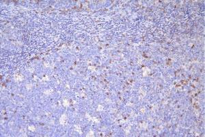 IHC analysis of CD79A using anti-CD79A antibody (ABIN7599837).